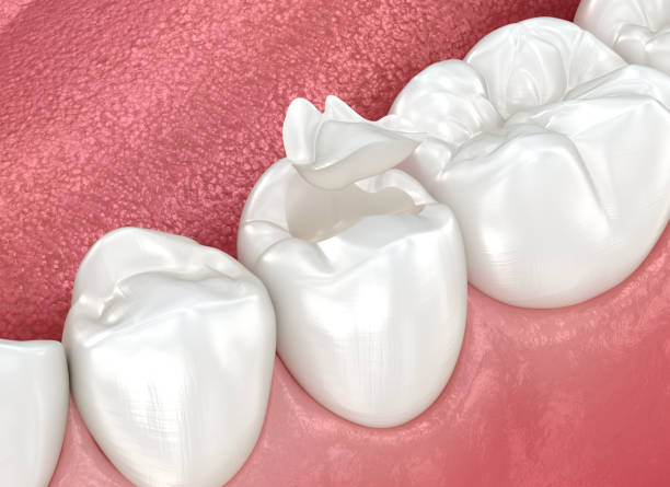 Our Range of Dental Services in Beacon, NY